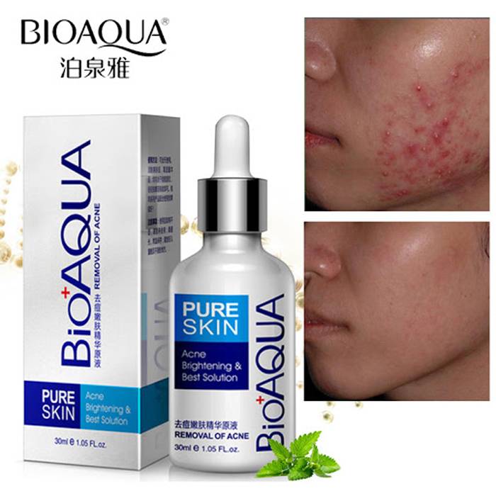 KIT ANTI ACNE BIOAQUA