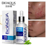 KIT ANTI ACNE BIOAQUA